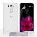Διάφανη Θήκη LG G4 by YouSave (Z006)